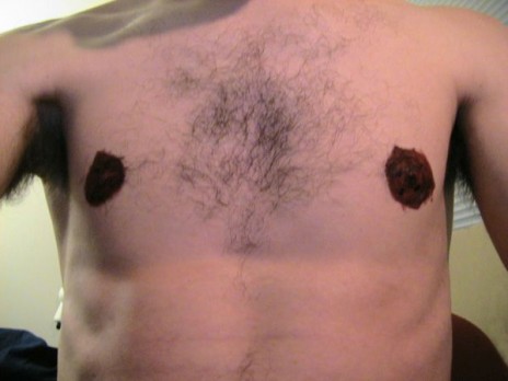 The discussion and theory of pepperoni nipples