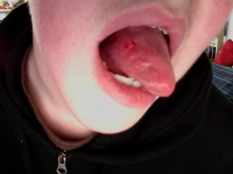 I bit my tongue.