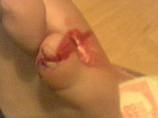 I hurt my little toe :'(